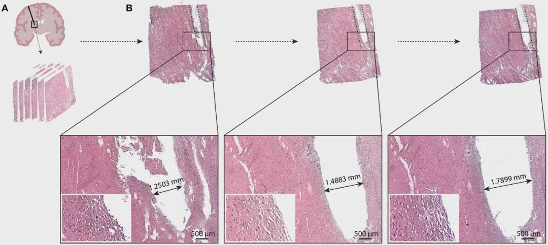 国家专项新突破！中国团队自主研发核磁兼容手术机器人，实现亚毫米级精度！(图8)